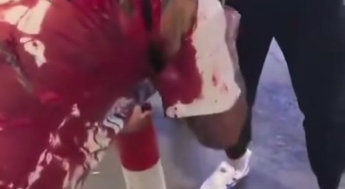 After the man was brutally stabbed