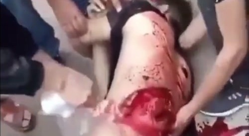 Gruesome aftermath of an attack in China