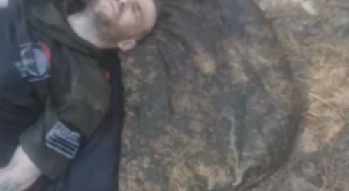 Russian soldier lost his lower legs...