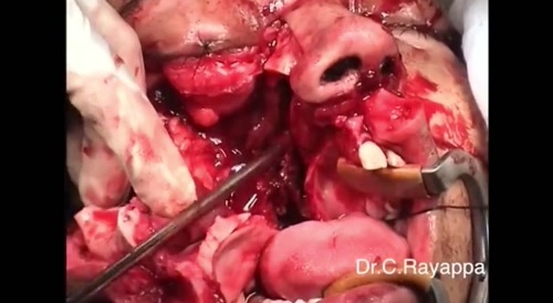 Surgeries (Music)