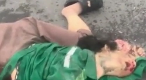 Human roadkill