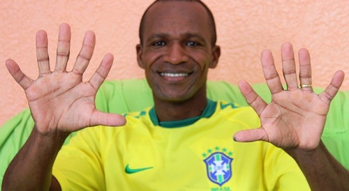 homem com 6 dedos em cada mão