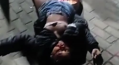A motorbike mishap with 2 people : 1 appears dead, 1 alive...