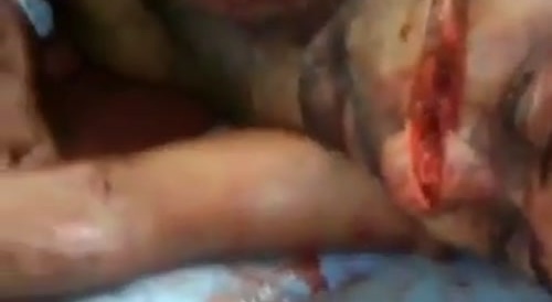 Man has all the looks of a machete attack...