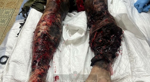 Product of a Ukrainian FPV Strike on a VDV Convoy