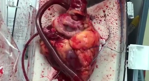 Pulsing out of body
