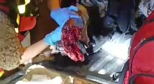 Extortionist lost his hand after a TNT explosion...