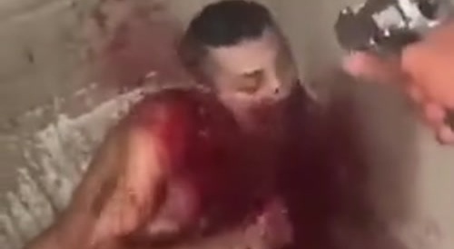 Shot In The Face Multiple Times