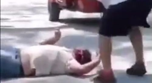 Machete attack in broad daylight