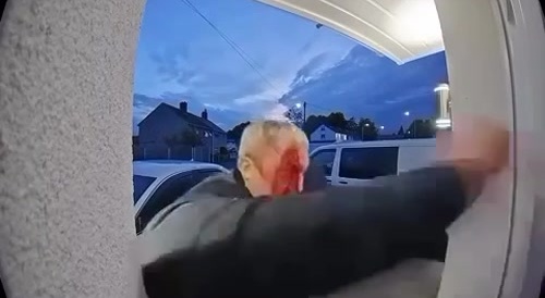 Pedophile Attacked with Crossbow Caught on Ring Cam