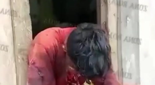 Dude shot himself in the fucking face & still alive