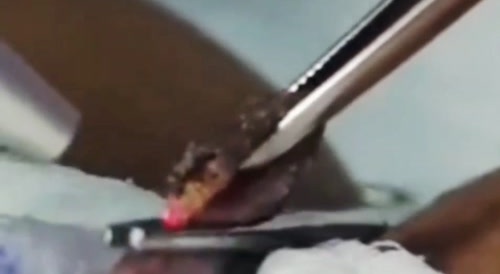 Pussy meat