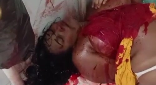 Stabbed And Dying In A Bathroom.