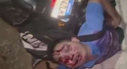 Freak accident in Guatemala
