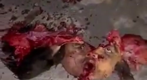 Motorcycle Accident