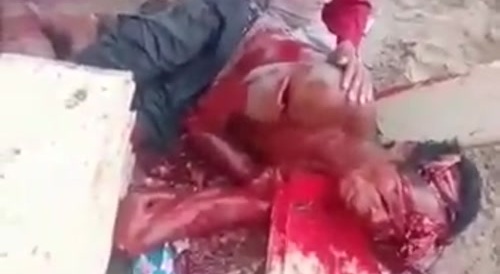 Old Man Gets Hacked By A Machete