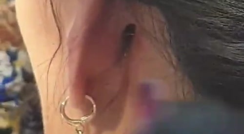 Outlandish Ear Infections