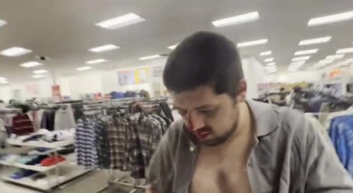 Pedo Made To Bleed For His Sins