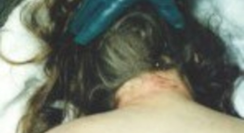 body of a woman found in snow