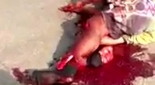 badly injured
