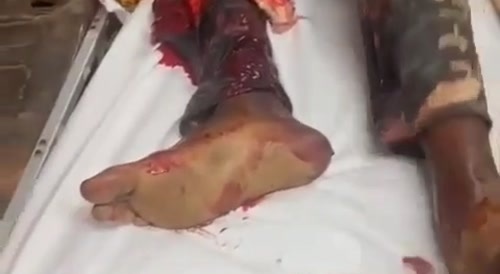 A terrible traffic accident