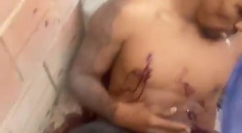 Aftermath of Police Raid in Rio's Favela