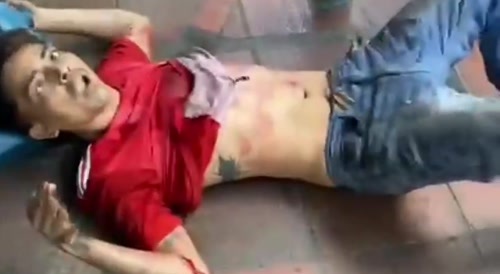 This young man was shot by unknown persons