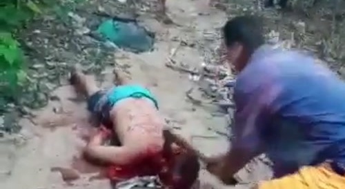 Skull Smashing In Brazil