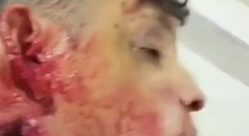 a man with his head cut off after hitting a road barrier that was being repaired