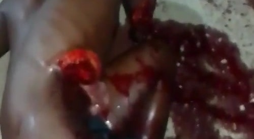 Eviscerated By A Machete