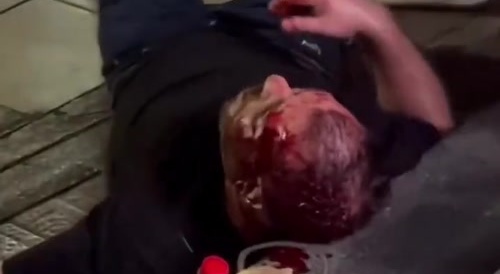 Tourist Beats LadyBoys
