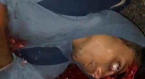 Cyclist got his brains blown out