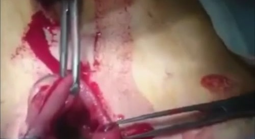 Man is a "toothbrush."