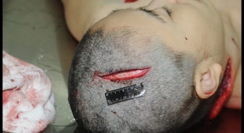 Someone Really Wanted Her Dead