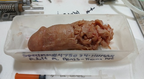 Detached penis examined