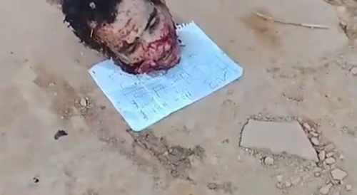 Deep Thigh Death Wound