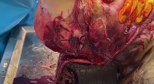 This Is A Very Interesting Autopsy!