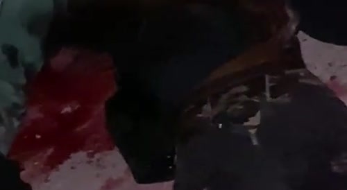 Two Men Bleed Out, over a dame