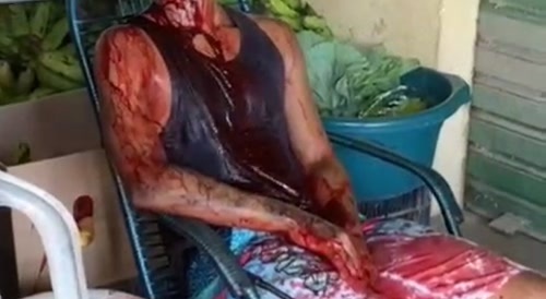 Just Let Him Bleed Out