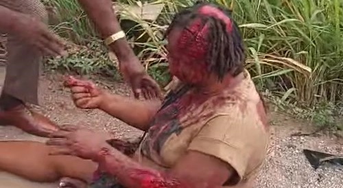 She Got Partially Scalped