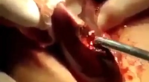 Your liver on sashimi