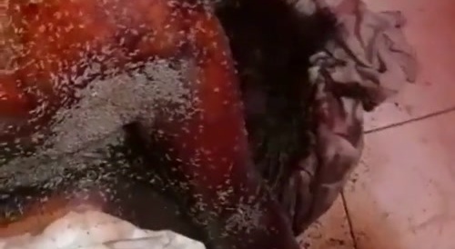 Woman Found Not Looking So well