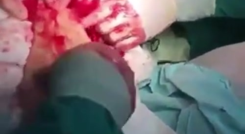 Giving Birth To A Weiner