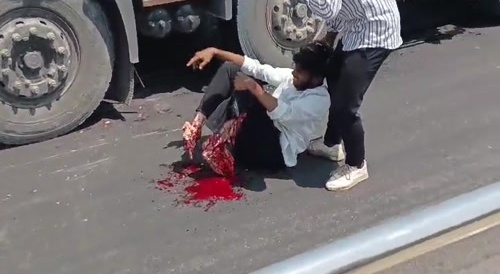 Guy's leg crused by truck