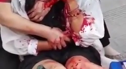 Poor Woman has Face Cut in Half