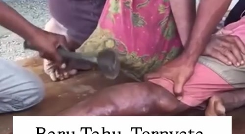 When Your Health Insurance Runs Out