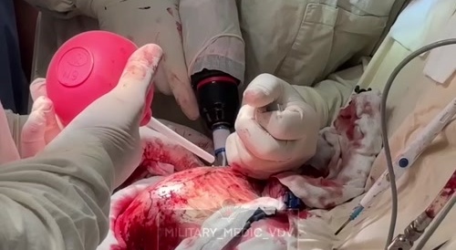 Video from a military hospital.