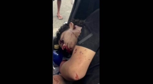 Dude Shot Dead in car