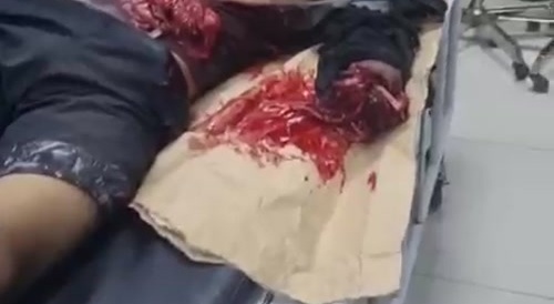 Stupid criminal dies by his own explosive 3