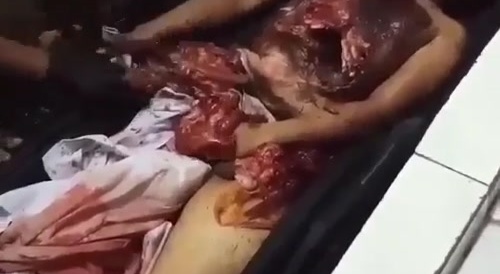 He Was Saved, And Put Back Together